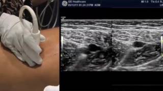 How To Lower Extremity Ultrasound