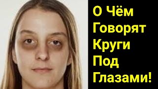 картинка: Тёмные Круги Под Глазами | Доктор Вивек