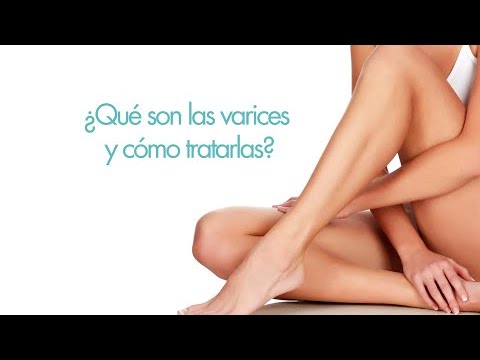 Que medicamento es mejor para las varices