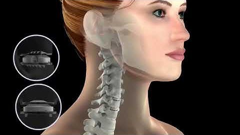 Mobi C short animation clip: movement in the neck