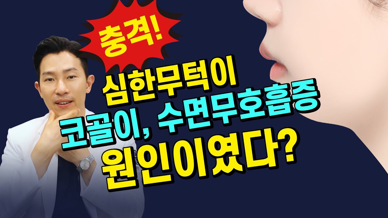 [미드라인]심한 무턱이 코골이, 수면무호흡증에 원인이였다?