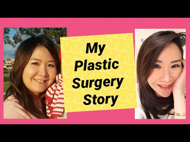 My Plastic Surgery Journey | Olivia Hans class=