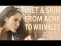 How Food Affects Your Skin: From Acne To Wrinkles