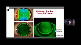 NIDEK | Meridia Webinar - Introduction to the Next Gen Corneal Topographer screenshot 3