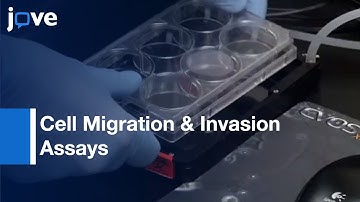 In vitro Cell Migration & Invasion Assays l Protocol Preview