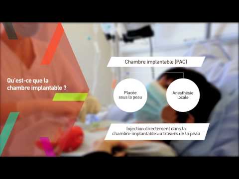 Vidéo: Schémas Et Prédicteurs Du Comportement à L'effort Pendant 24 Mois De Suivi Après Un Programme D'exercice Supervisé Pendant La Chimiothérapie Du Cancer Du Sein