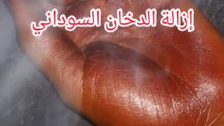 إزالة قشرة الدخان السوداني بمكونات موجودة في كل بيت رزاز ام محمد السودانية
