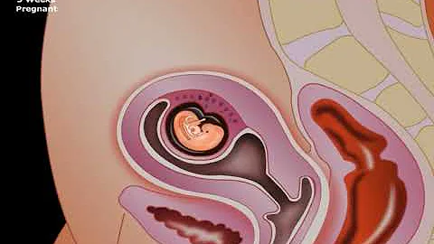 USMLE® Step 1  Neuroscience  Development of CNS Animation