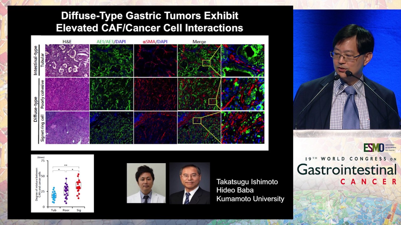 Keynote Lecture 1: Progress in unraveling the molecular taxonomy in gastric cancer