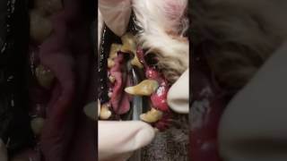 Periodontal disease- pre dental cleaning