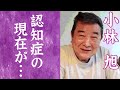 【驚愕】小林旭の認知症と言われる病状や悲惨な姿に涙が零れ落ちた...!『仁義なき戦い』で活躍した名俳優が"浅丘ルリ子 "と結婚できなかった理由や裏社会との繋がりに一同驚愕...!