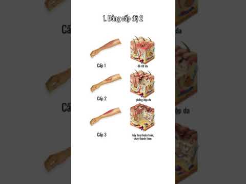 caocuongvu | Những