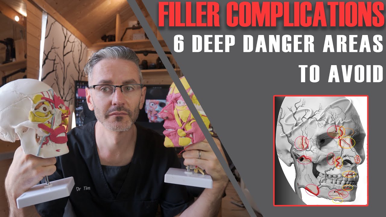 Don't Inject DEEP Here! 6 Filler Complications Danger Points You Must Know [Aesthetics Mastery Show]