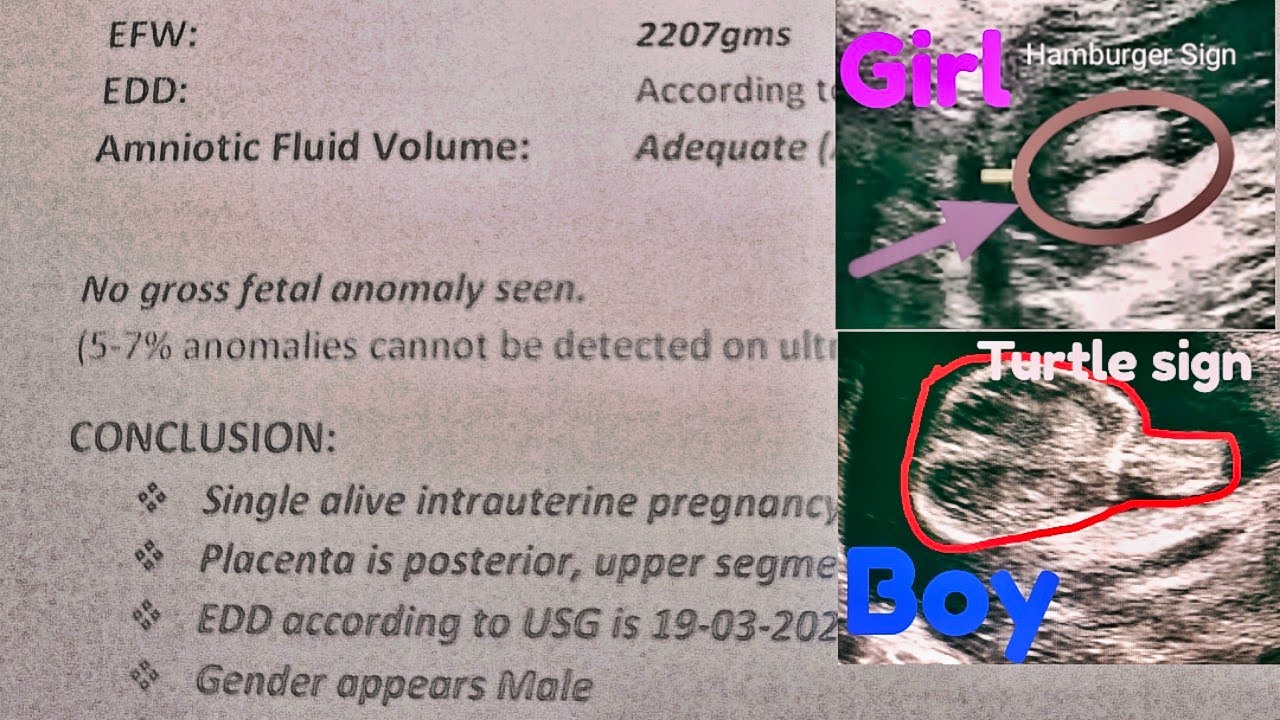 How To Know Baby Boy Or Girl In Ultrasound Report Urdu Hindi YouTube how-to-know-baby-boy-or-girl-in-ultrasound-report-urdu-hindi-youtube