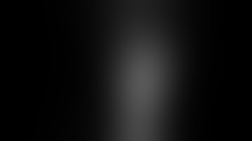 Percutaneous intramedullary screw fixation of metacarpal and phalangeal fractures