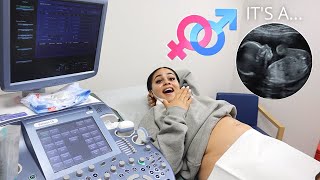 WE FOUND OUT THE GENDER OF OUR BABY!! *SURPRISED!*