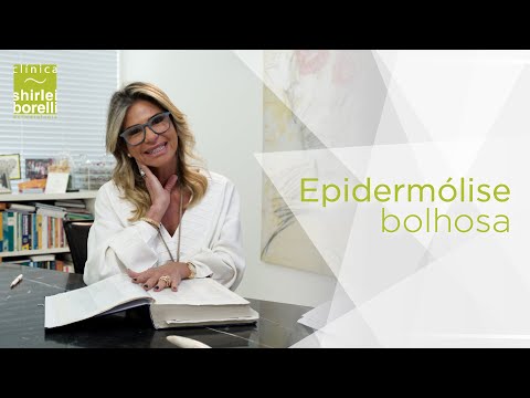 Vídeo: Recomendações Psicossociais Para O Cuidado De Crianças E Adultos Com Epidermólise Bolhosa E Sua Família: Diretrizes Baseadas Em Evidências