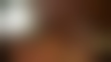 Laparoscopic appendectomy. Dr. Stefanos Psomas MD PHD. part2