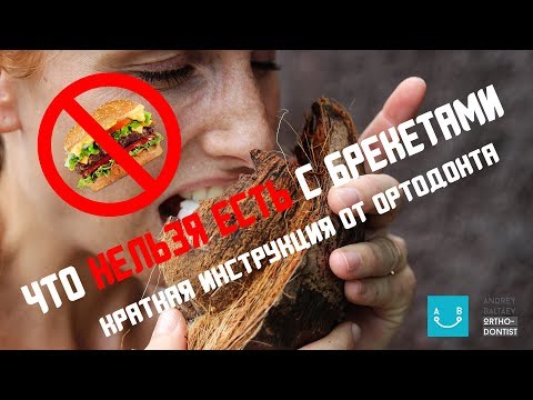 Влог Ортодонта #4 - Что нельзя есть с брекетами?