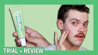 topicals sealed active scar filling primer | trial + review