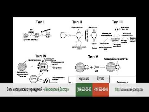 Типы аллергических реакций