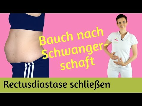 Video: Postpartale Bauch: Wie Man Es Loswird