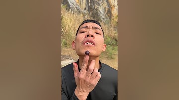 How I Cured a Bug Bite with Yogurt in theWild | Survival Hacks💦