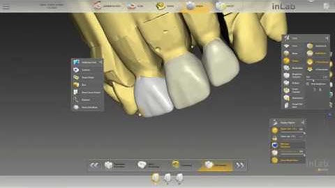 Quick Shot of Before And After Design on InLab 18