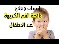 رائحة الفم الكريهة عند الاطفال الاسباب والعلاج 