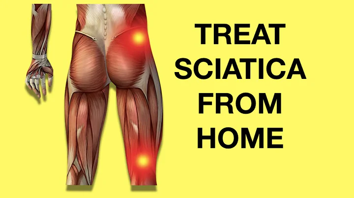 Sciatica: Causes, Symptoms, Diagnosis, BEST Exercises & Stretches (Home Treatment)