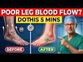 Surgeon Reveals: Poor Leg Circulation? 30-Second Test + 5 Fast Fix Exercises | Senior Health
