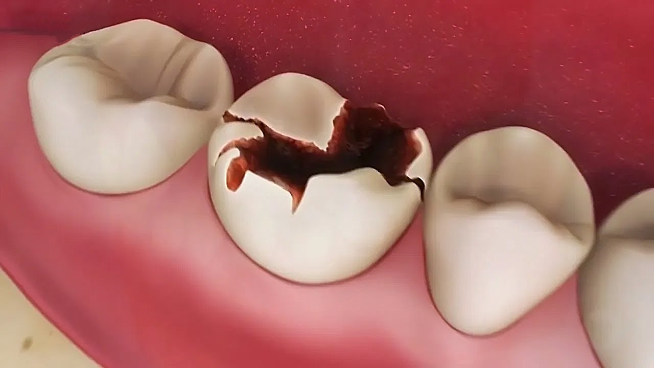 All dental services (các dịch vụ nha khoa)