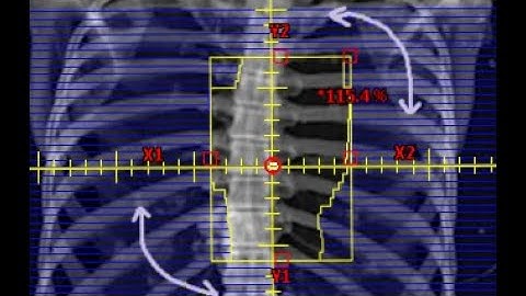 Rotate Collimator and Maintain Blocks in Eclipse