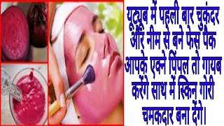 Chukandar And Neem Face Pack | Beetroot Face Pack For Skin Whitening In Hindi | Chukandar Faxe Pack