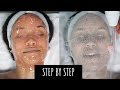 I GOT A PROFESSIONAL FACIAL! | STEP BY STEP + CLEARING HORMONAL ACNE