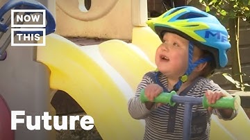 3D Printing Helps Doctors Transplant Father