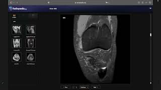 MRI Gối Thầy Hùng