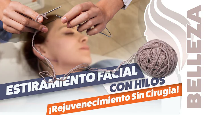 ESTIRAMIENTO FACIAL con HILOS MS JOVEN SIN CIRUGIA...