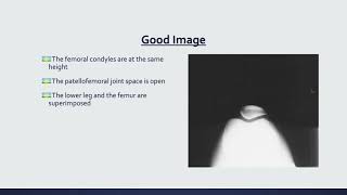 Rads 4510 Image Analysis Powerpoint Presentation