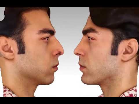 Video: Jak Určit Ideální Tvar Nosu Pro Váš Obličej