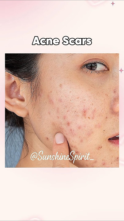 skincare tips 🎀✨| #aesthetic #shorts #fyp #beauty #beautiful