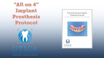 "All on 4" Full Zirconia Arch Procedure Protocol