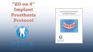 'All on 4' Full Zirconia Arch Procedure Protocol by Utica Dental Lab 1,775 views 1 year ago 5 minutes, 24 seconds