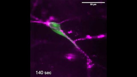 Glioma Cell Migration Dynamics in Brain Tissue Assessed by Multimodal Optical Imaging