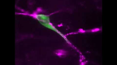 Glioma Cell Migration Dynamics in Brain Tissue Assessed by Multimodal Optical Imaging