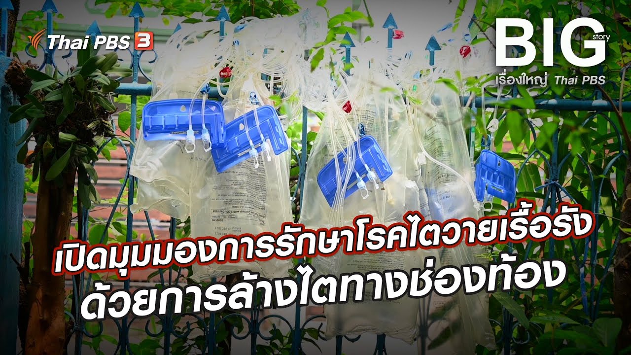 เปิดมุมมองการรักษาโรคไตวายเรื้อรังด้วยการล้างไตทางช่องท้อง | Big Story เรื่องใหญ่ Thai PBS