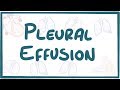 Pleural Effusion - causes, symptoms, diagnosis, treatment, pathology