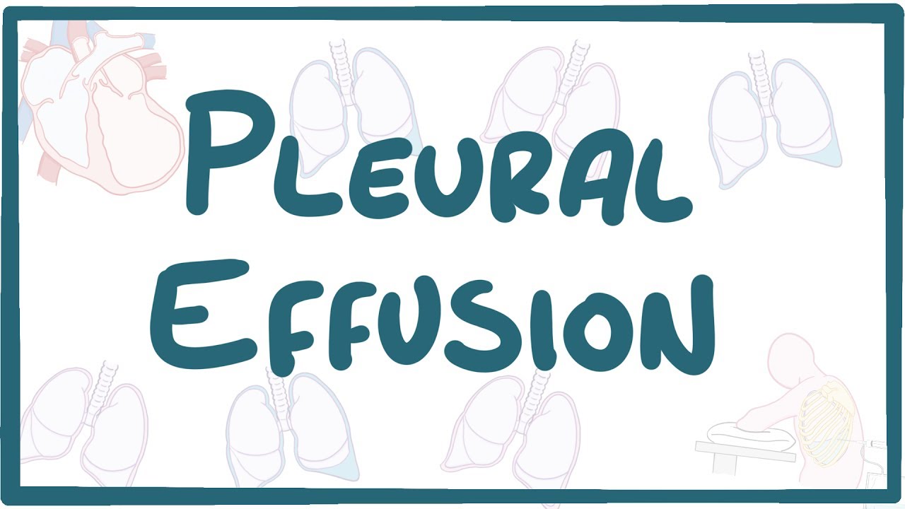 Pathophysiology Of Pleural Effusion In Flow Chart