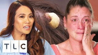 Dr. Pimple Popper Removes A Potentially Cancerous Horn | Dr. Pimple Popper