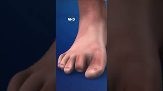 What is Claw Toe